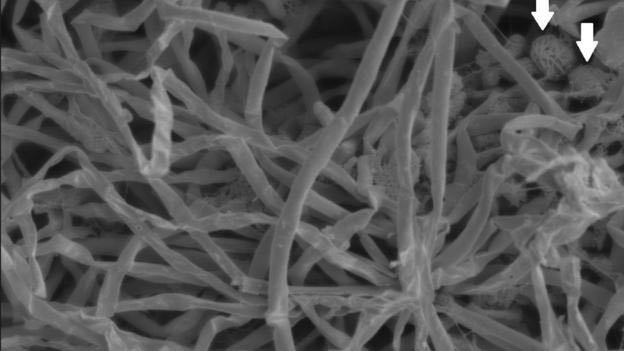 Biofilm dari tambang emas Kopanang. Panah-panah menujukkan individu bakteri. Kredit foto: Gaetan Borgonie/Nature Communications