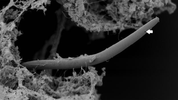 Monhystrella parvella, cacing nematode. Kredit foto: Gaetan Borgonie et al