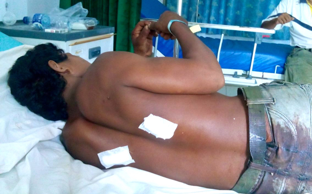 Besaring, Orang Rimba korban luka-luka yang dirawat di Rumah Sakit Daerah Sarolangun. Foto: KKI Warsi