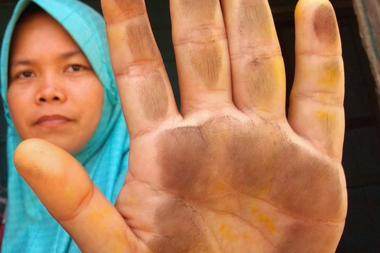 Maryani memperlihatkan tangannya penuh debu batubara. Padahal itu di dalam rumah. Foto: Yitno Suprapto/ Mongabay Indonesia