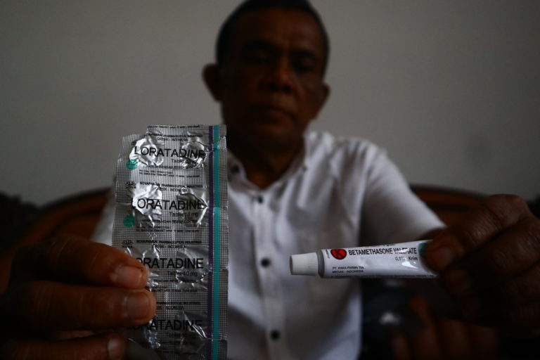 Salep dan obat yang digunakan warga kala keluhan seperti gatal-gatal menimpa mereka. Foto: Jaka HB/ Mongabay Indonesia